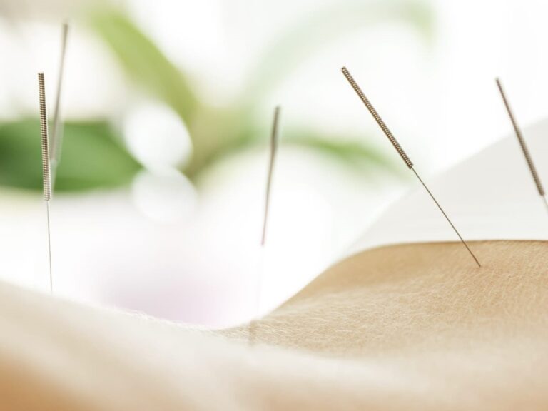 Acupunctuur Holistic Balance product